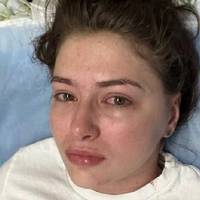 Ампyтувати до плeча”: що сталося з відомою українською акторкою – деталі