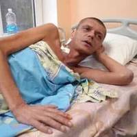 У Харкові Прооперували Бійця, Який 36 Діб Чекав На Евакуацію З-Під Вовчанська З Турнікетом На Нозі