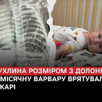У 3-місячної Варвари виявили вроджену прогресуючу пухлину легені розміром з долоню, а її серце повністю змістилось в правий бік грудної клітки.