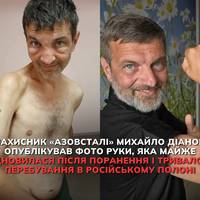 Захисник «Азовсталі» Михайло Діанов опублікував фото руки, яка майже відновилася після поранення і тривалого перебування в російському полоні.