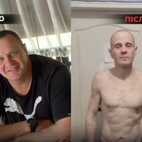 Такий вигляд має Сергій після російського полону.  Рідні та друзі навіть не могли впізнати його.