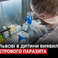 Вперше випадок рідкісного паразитарного захворювання — дифілоботріозу, у 10-річного хлопчика виявили медики у Львові.