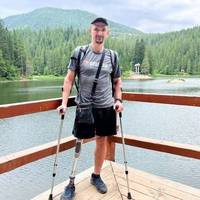 💙 «Я вижив — і це головне». Історія воїна Сергія Супряги, який втратив ногу, але не силу духу