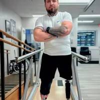 💙 Ампутація обох ніг, 25 операцій і роль у фільмі. Історія захисника Дмитра Колесника, який не зламався