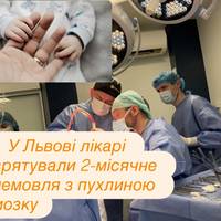 У Львові лікарі врятували 2-місячне немовля з пухлиною мозку