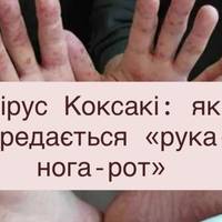 Вірус Коксакі: як передається «рука-нога-рот», чому висока температура та висип — і коли варто бити на сполох