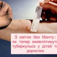 З квітня без Манту: як тепер виявлятимуть туберкульоз у дітей та дорослих