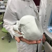 Живі кістки на 3D-принтері: Чехія виводить медицину майбутнього